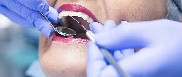 Best Emergency Cosmetic Dentistry (e.g., broken veneers) in Newark, CA